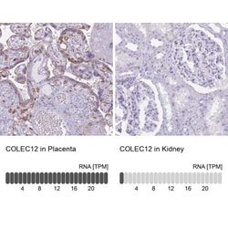 CL-P1/COLEC12 Antibody, Novus Biologicals 25 &mu;L, Unlabeled:Antibodies,